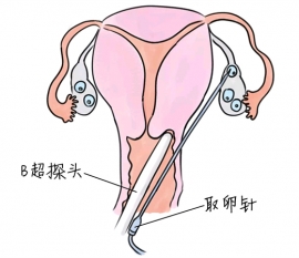 幼儿学画画，宁波捐卵宝宝学画画，学画画的好处，如何学画画