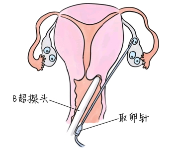 幼儿学画画，宁波捐卵宝宝学画画，学画画的好处，如何学画画